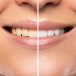 5 wskazówek, aby mieć zdrowe, białe zęby. Naturalne metody.